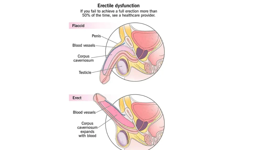 erectile dysfunction symptoms